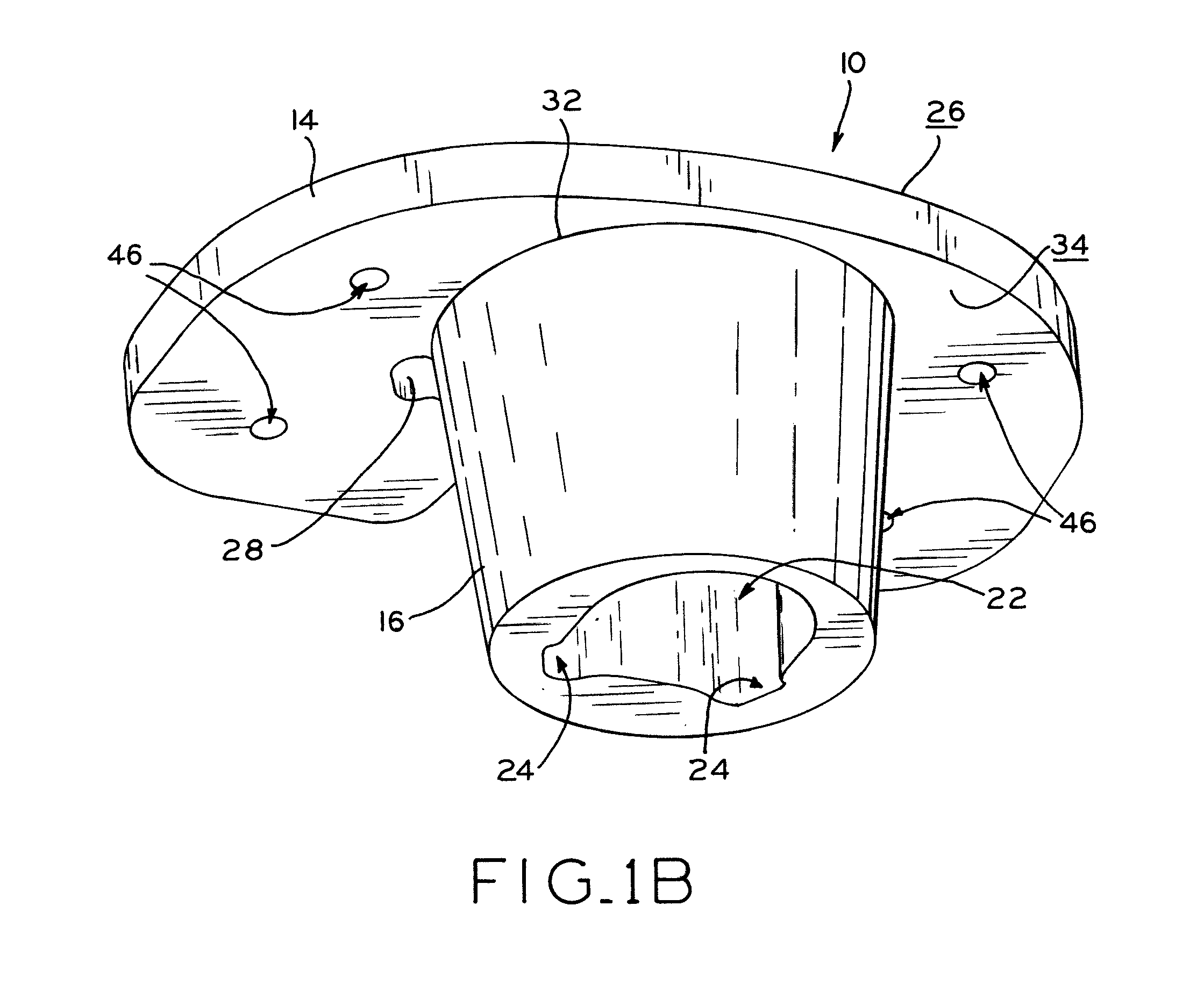 Stabilizing prosthesis support structure