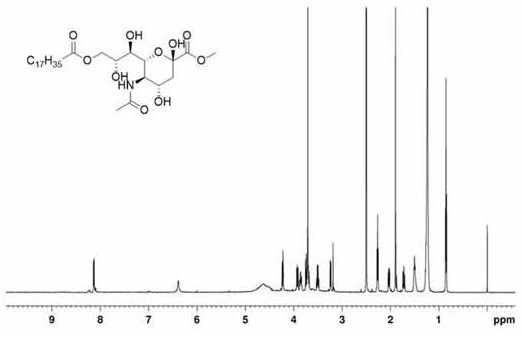 Sialic acid derivative modified ibrutinib (IBR) nanocomposite and preparation method thereof