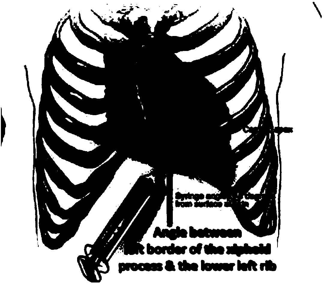 Dry puncturing method of dry pericardium