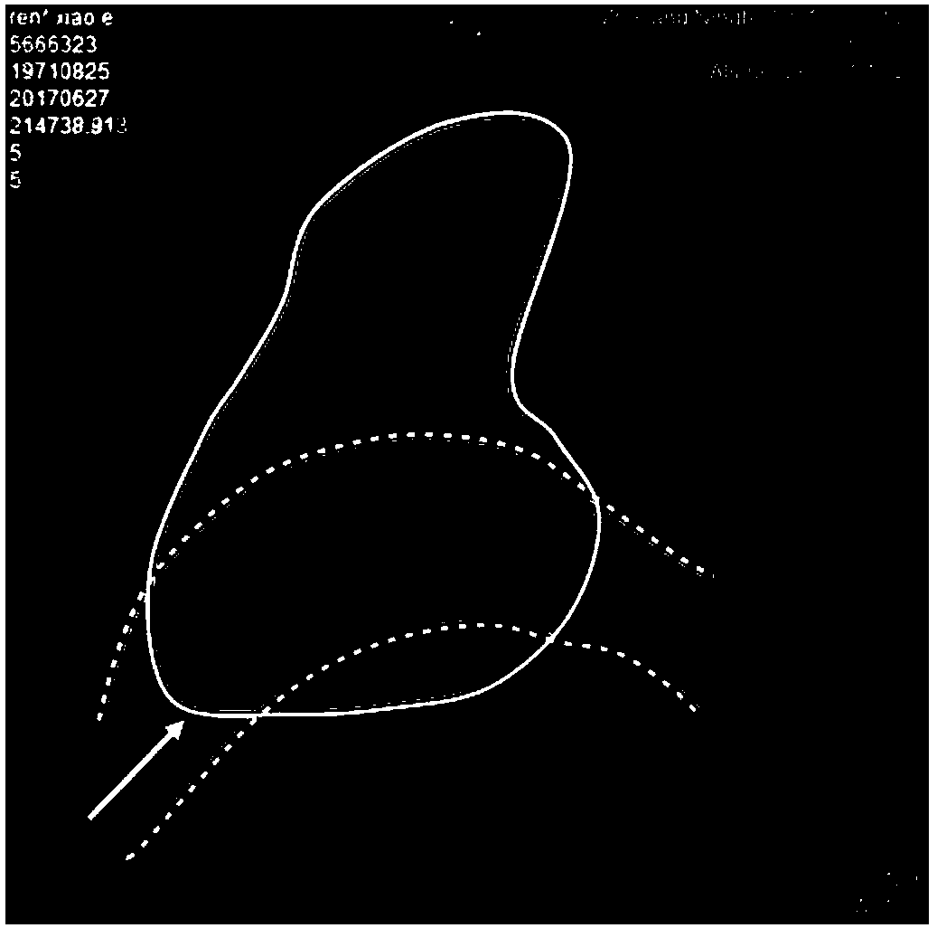 Dry puncturing method of dry pericardium