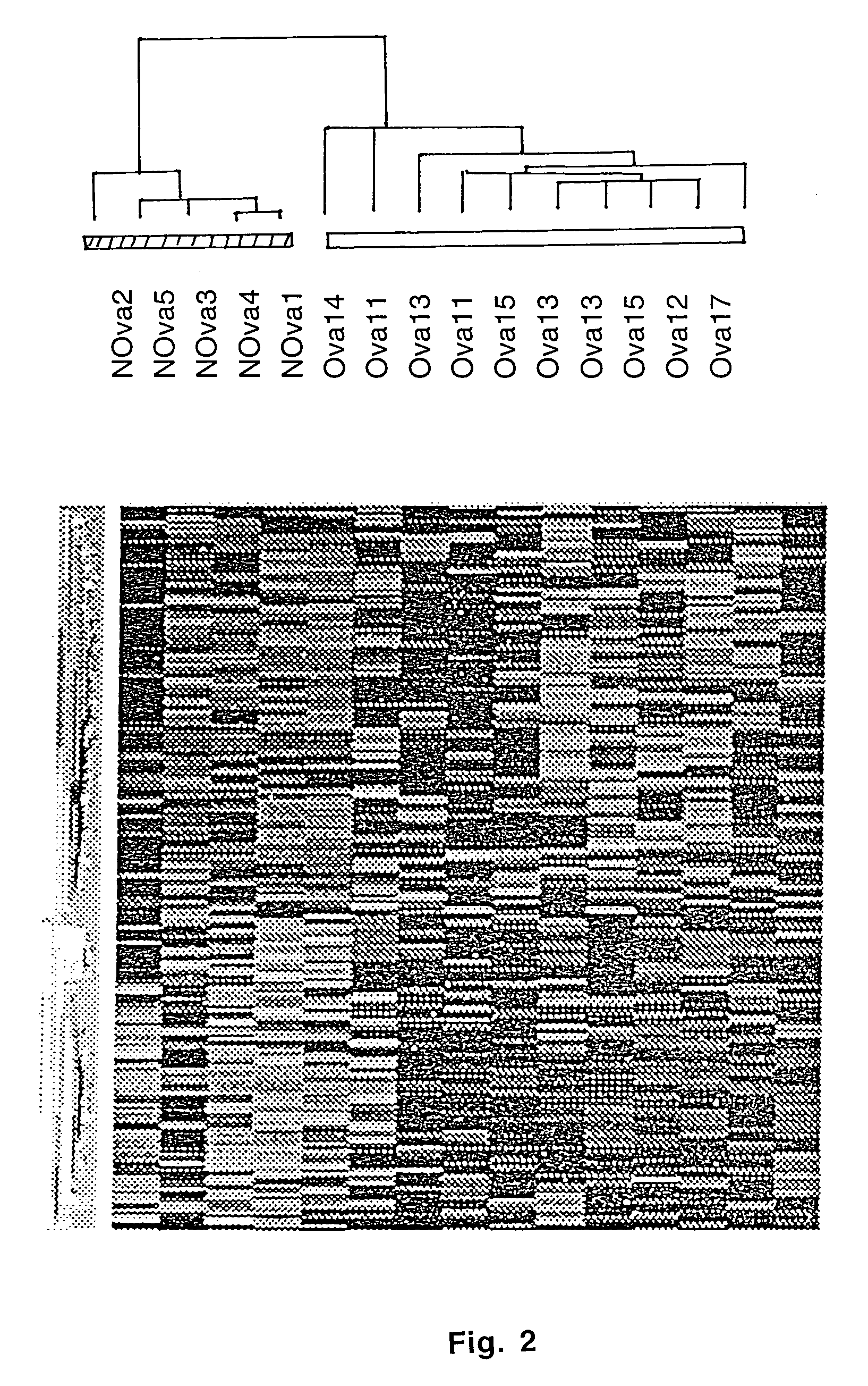 Gene expression profiling in primary ovarian serous papillary tumors and normal ovarian epithelium