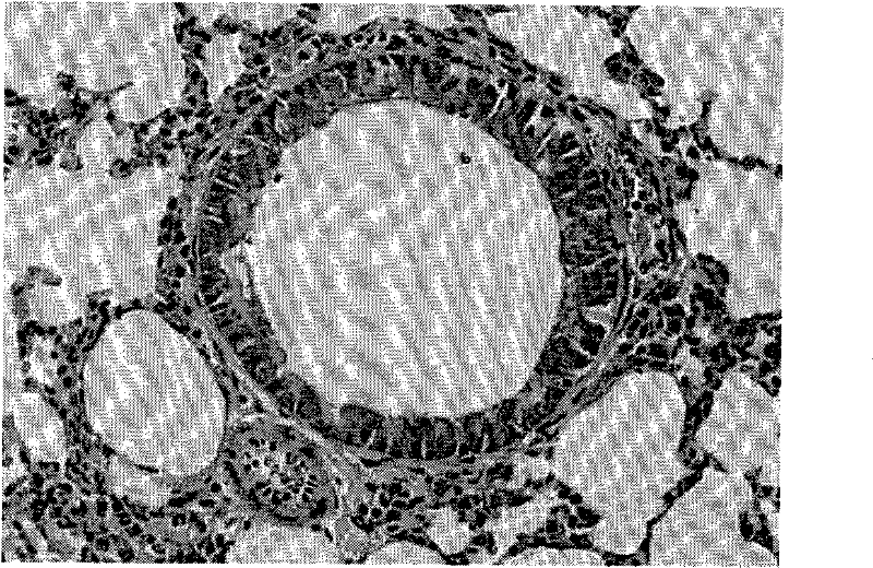 Smoke exposure device used for establishing chronic obstructive pulmonary disease model