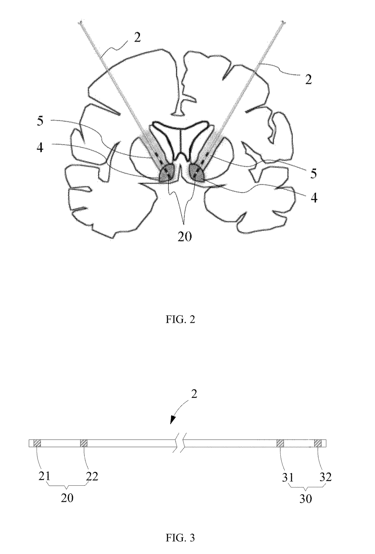 Lead, device and method for electrical stimulation of deep brain