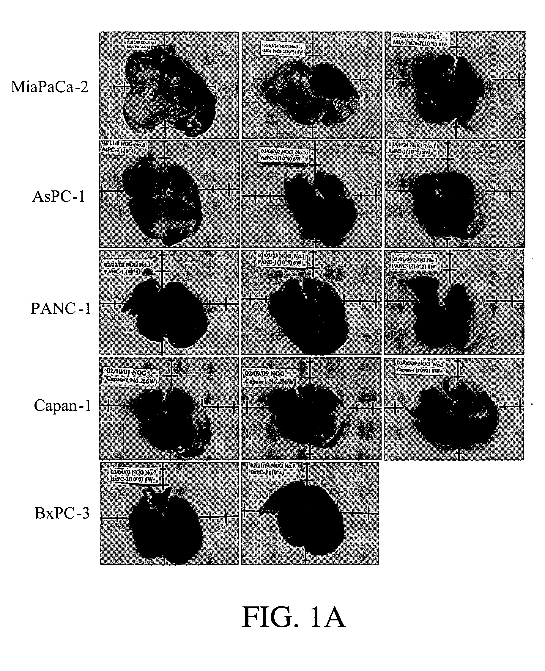 Establishment of human cancer cell lines with metastatic potential using NOD/SCID