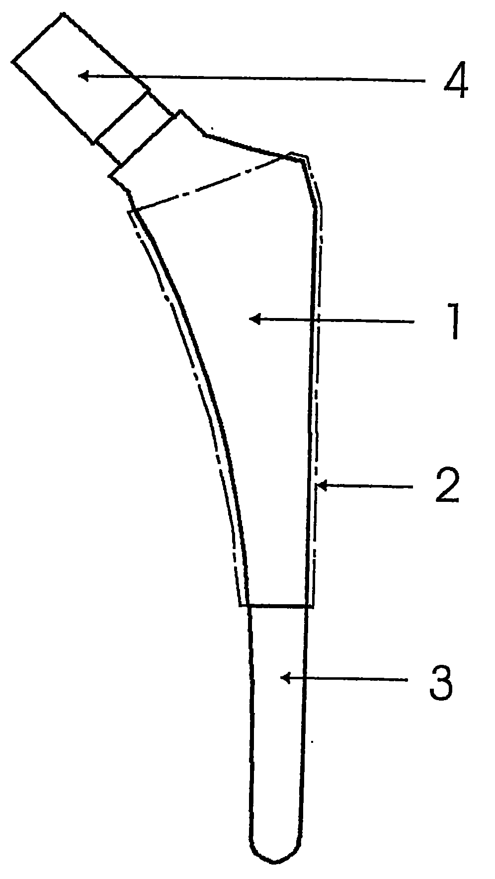 Body joint replacement titanium implant comprising one or several base bodies