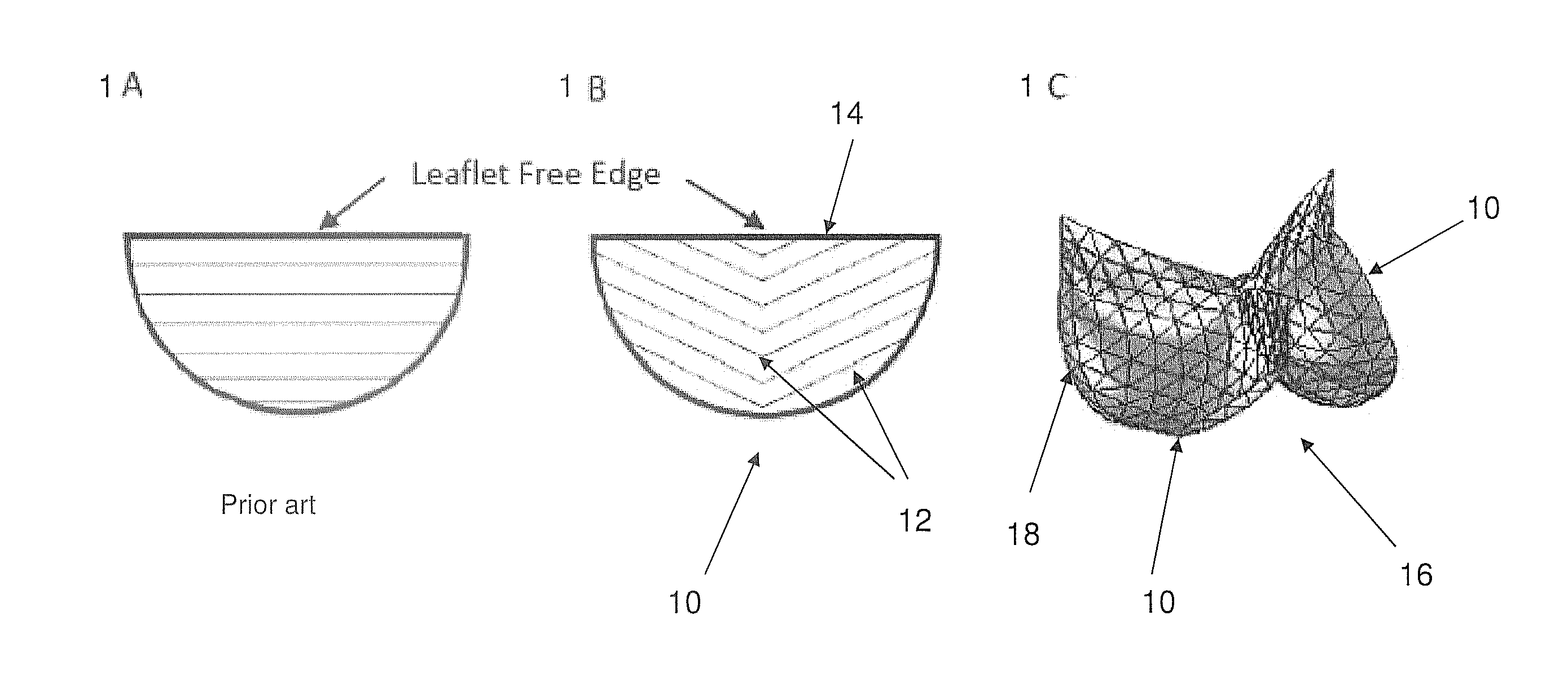 Curved fiber arrangement for prosthetic heart valves