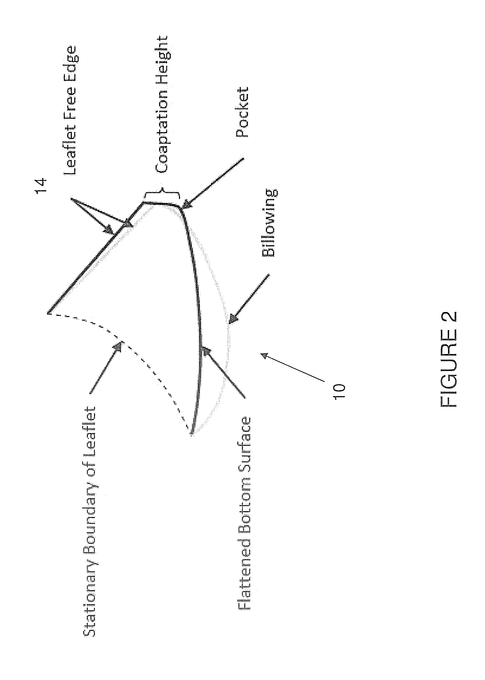 Curved fiber arrangement for prosthetic heart valves