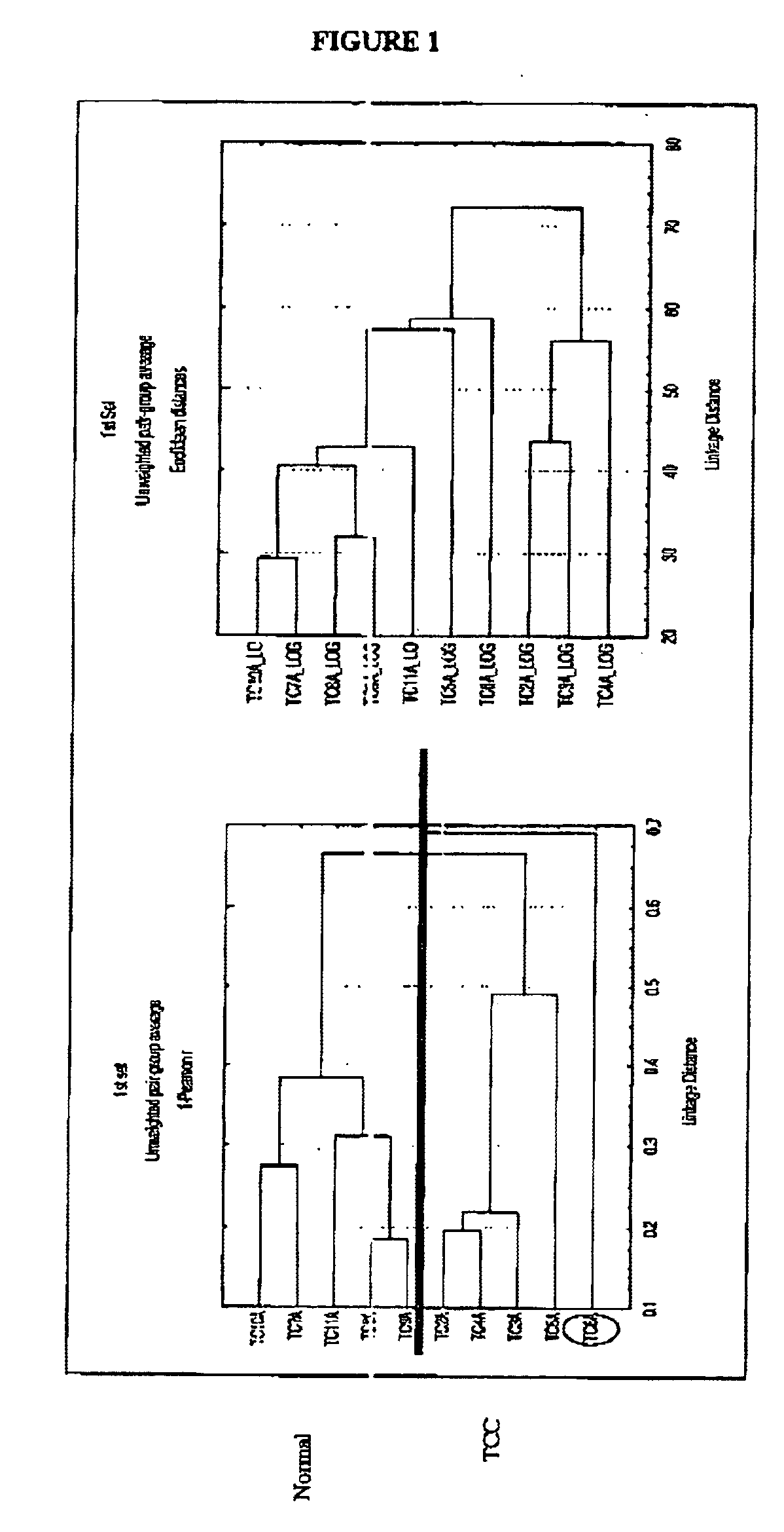 Methods of diagnosing bladder cancer