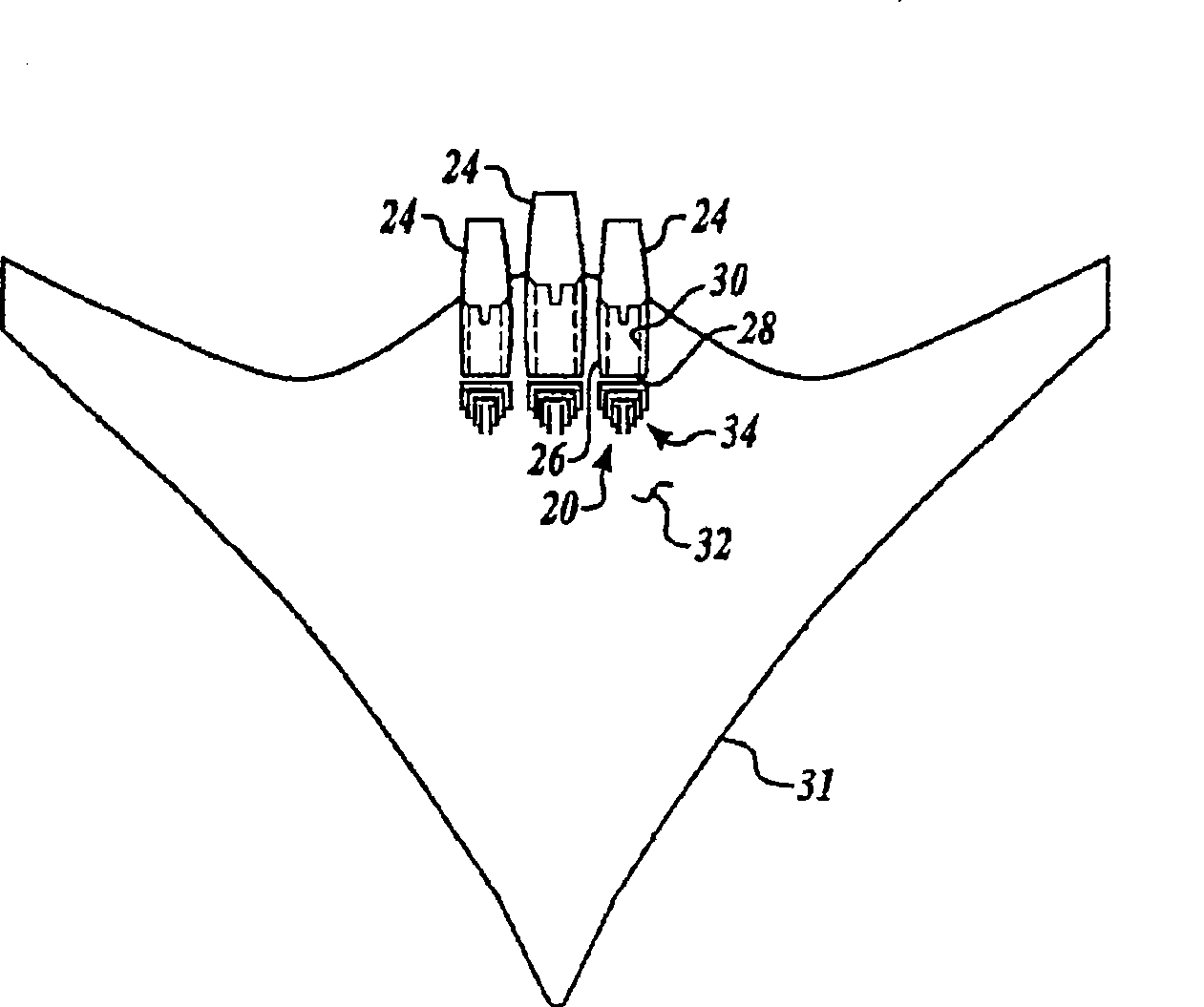 Inlet distortion and recovery control system