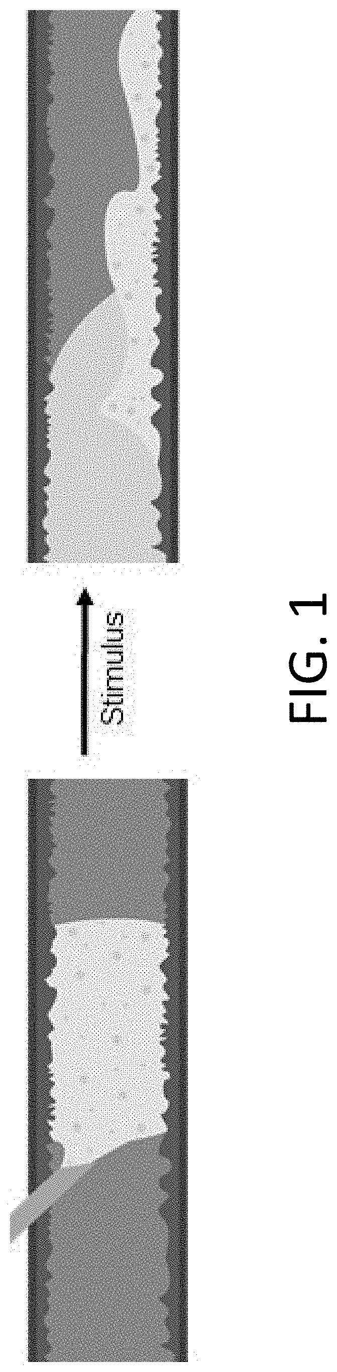 Methods for implanting and reversing stimuli-responsive implants