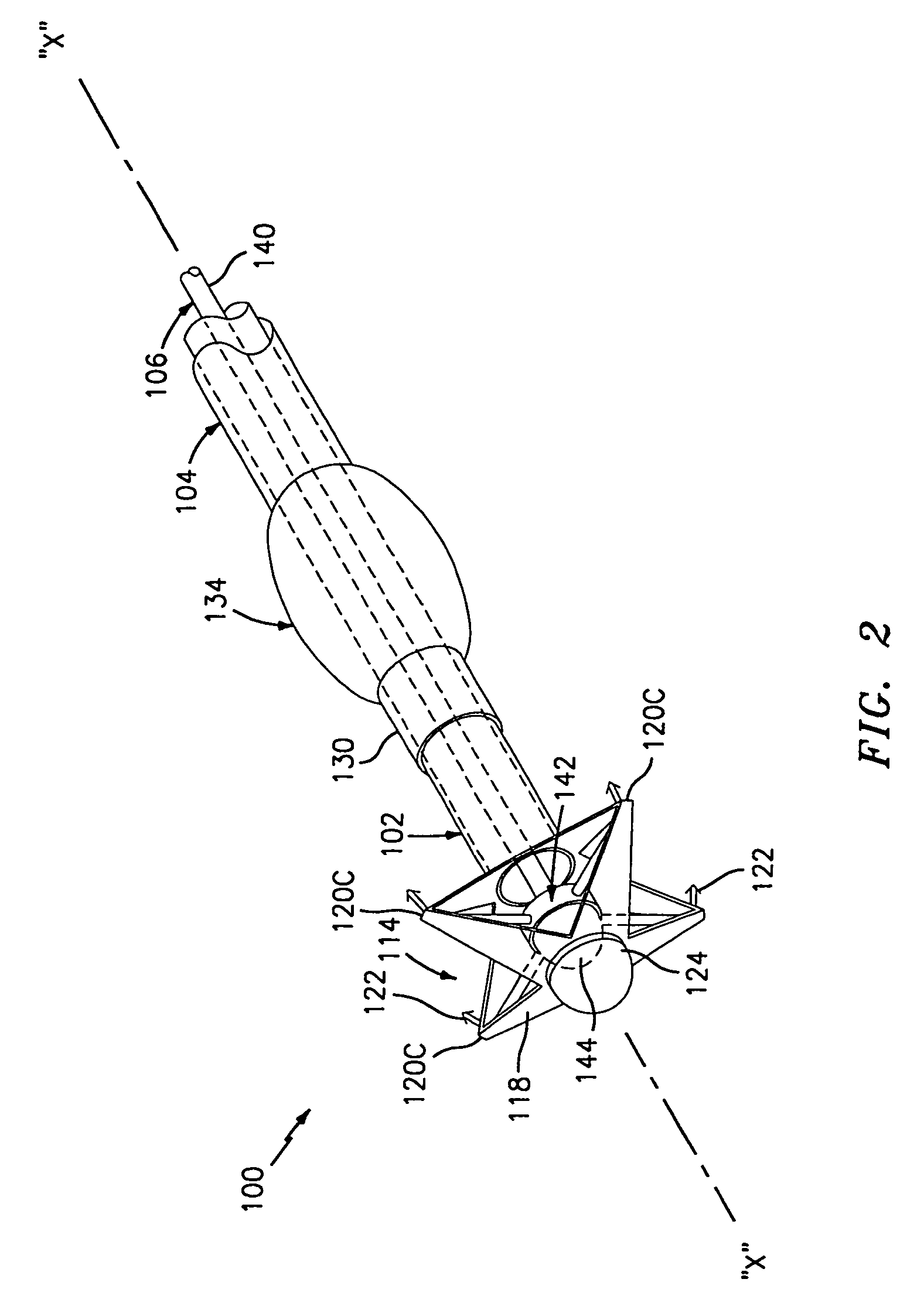 Method and apparatus for anastomosis including an anchoring sleeve