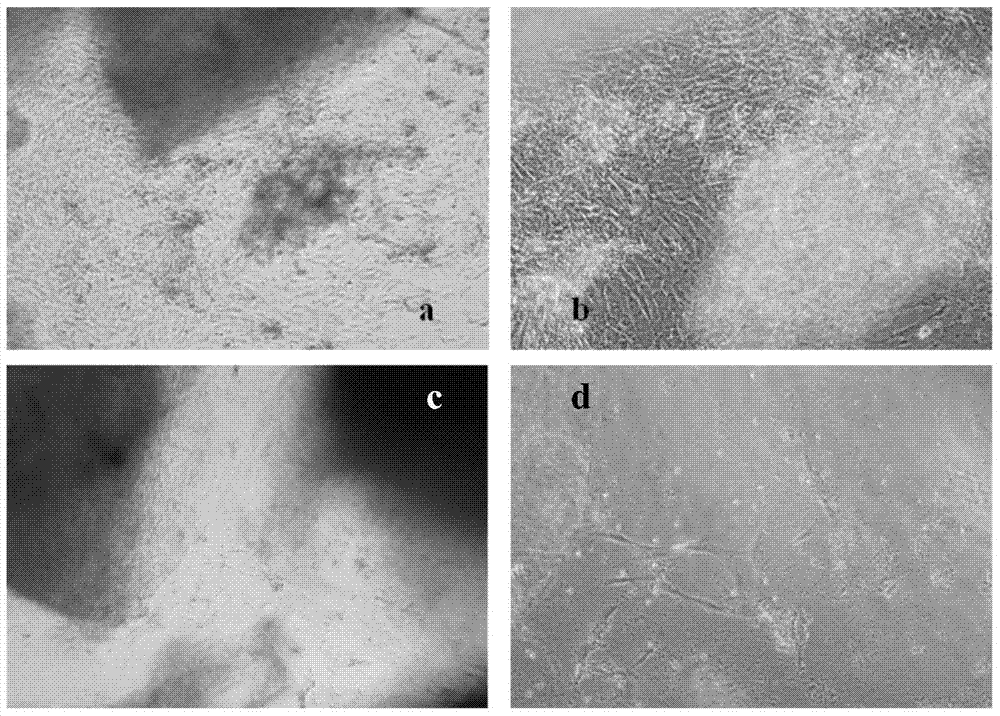 A kind of culture method of human umbilical cord mesenchymal stem cells