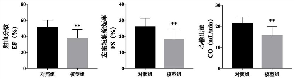 Radix stephaniae tetrandrae and radix astragali decoction and application of components thereof in preparation of myocardial hypertrophy resisting medicine