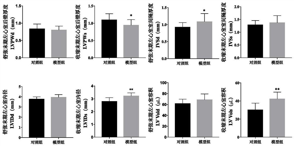 Radix stephaniae tetrandrae and radix astragali decoction and application of components thereof in preparation of myocardial hypertrophy resisting medicine