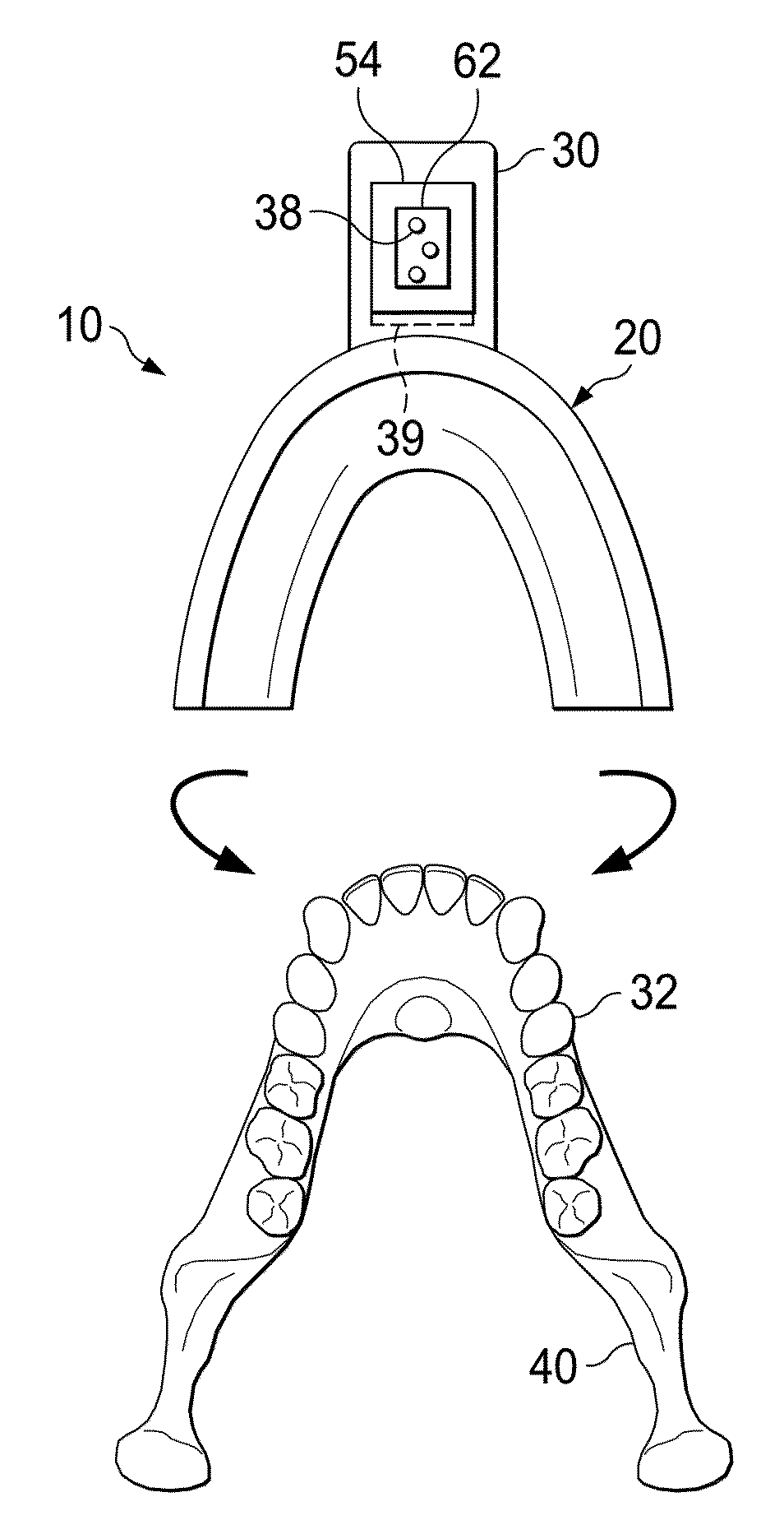 Pulsatile orthodontic device and methods