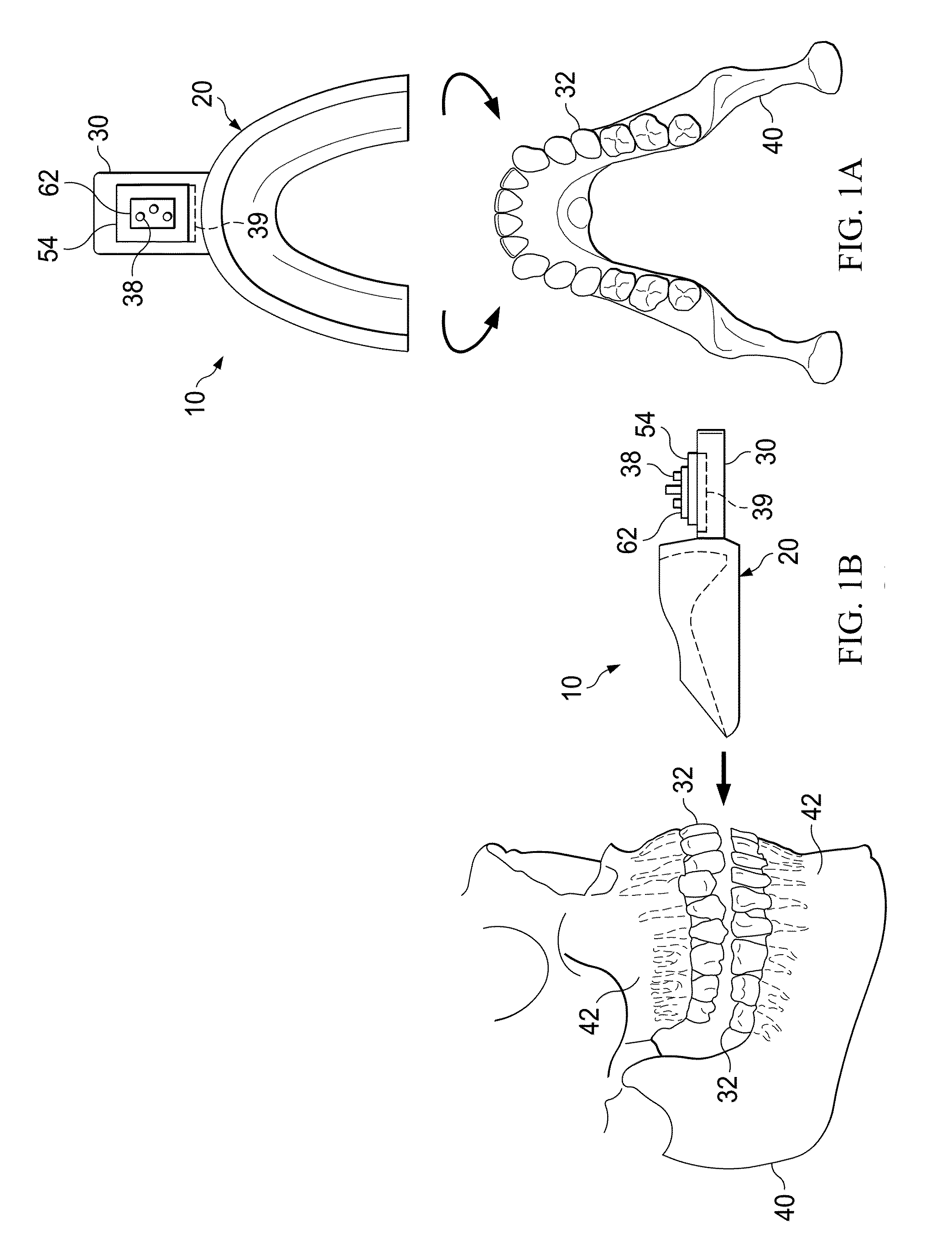 Pulsatile orthodontic device and methods