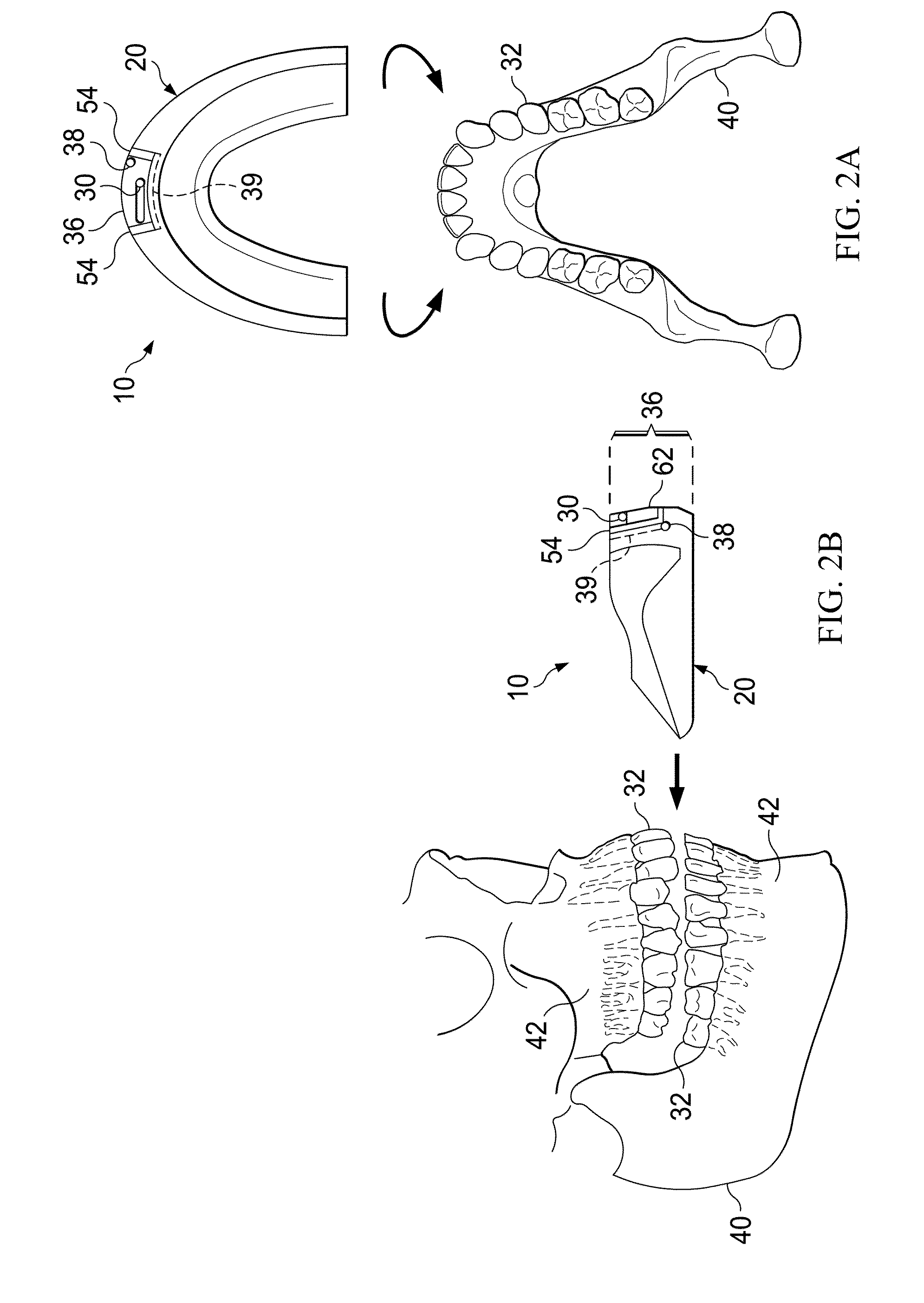 Pulsatile orthodontic device and methods