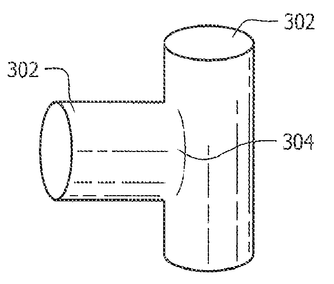 Porous implant structures