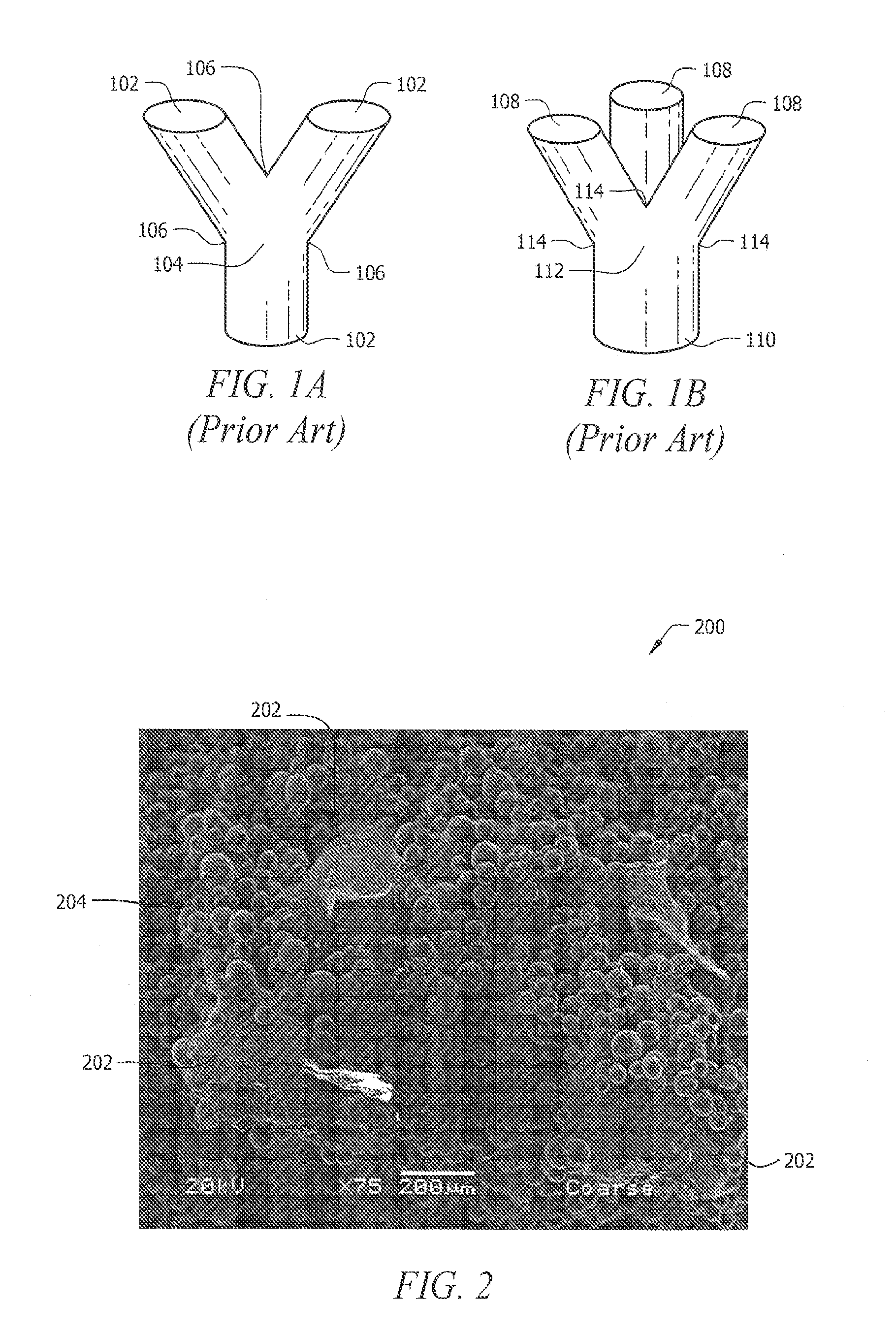 Porous implant structures