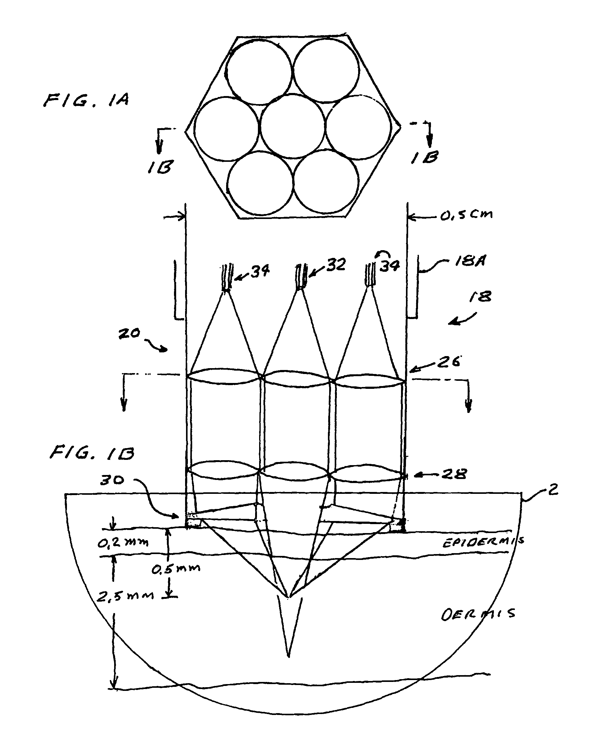 Skin treatment system with time modulated laser pulses