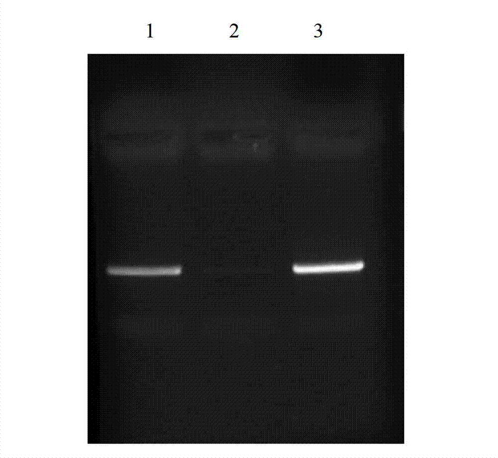 Extraction method of fly intestinal microorganism total DNA (deoxyribonucleic acid)