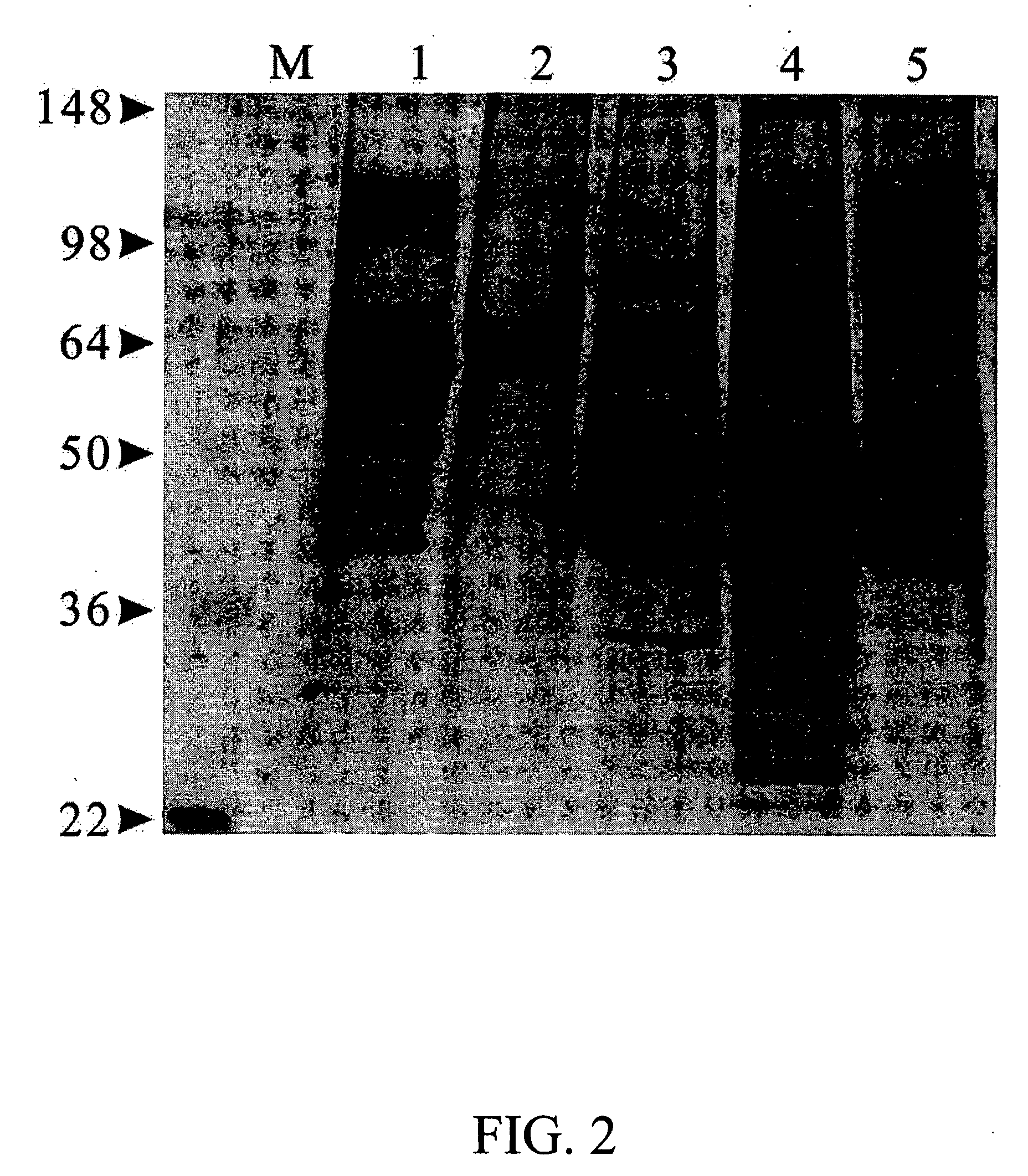 Novel microorganism strain GM-020 of Lactobacillus rhamnosus and its use for treating obesity