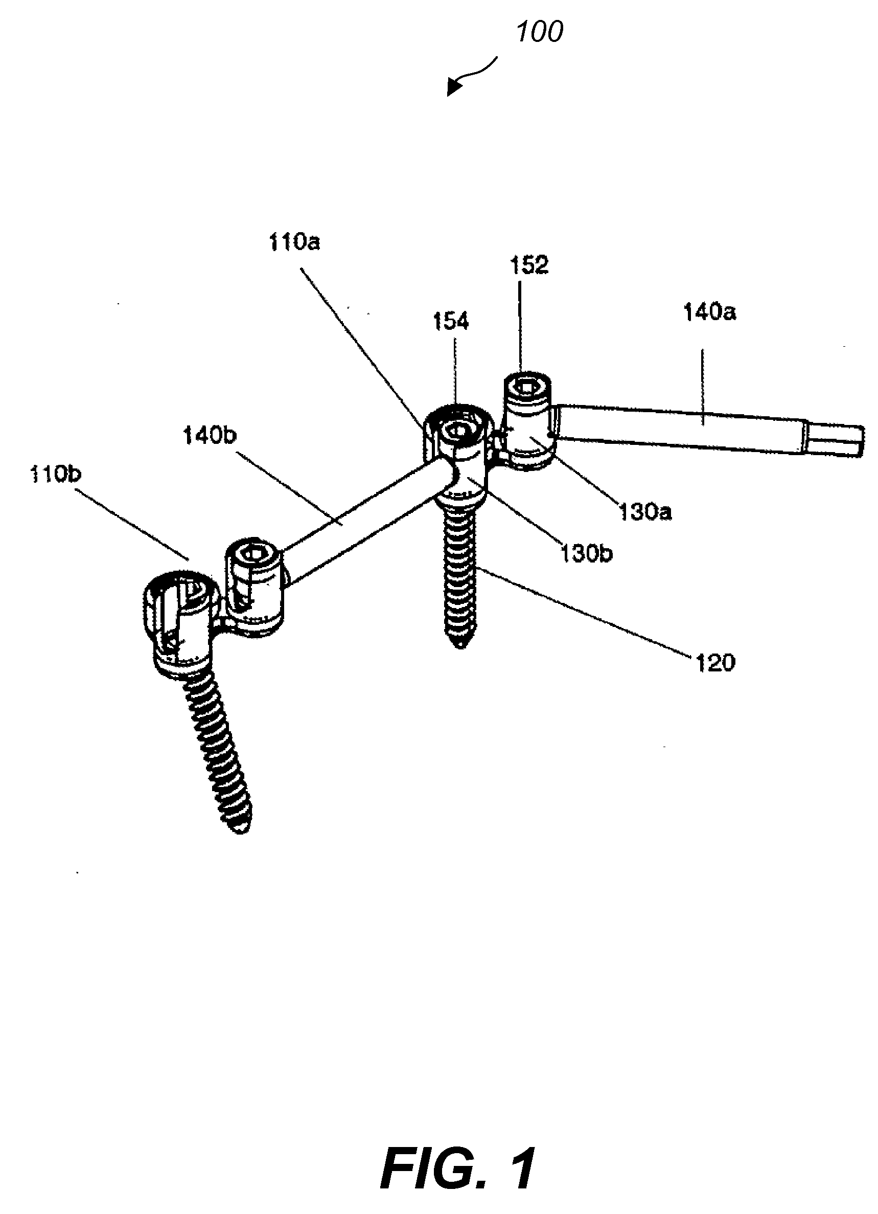 Spine fixation method and apparatus