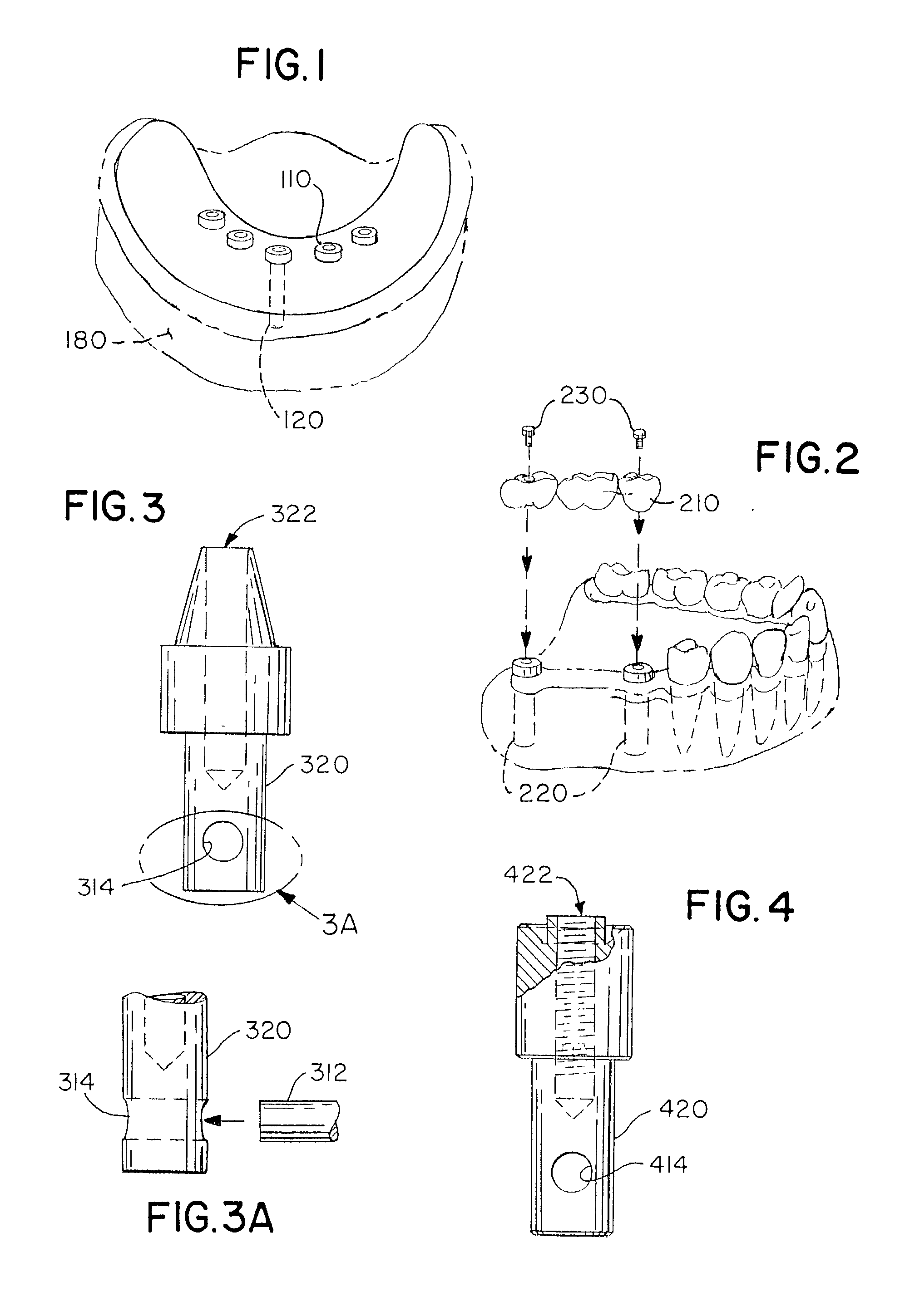 Stable dental analog systems