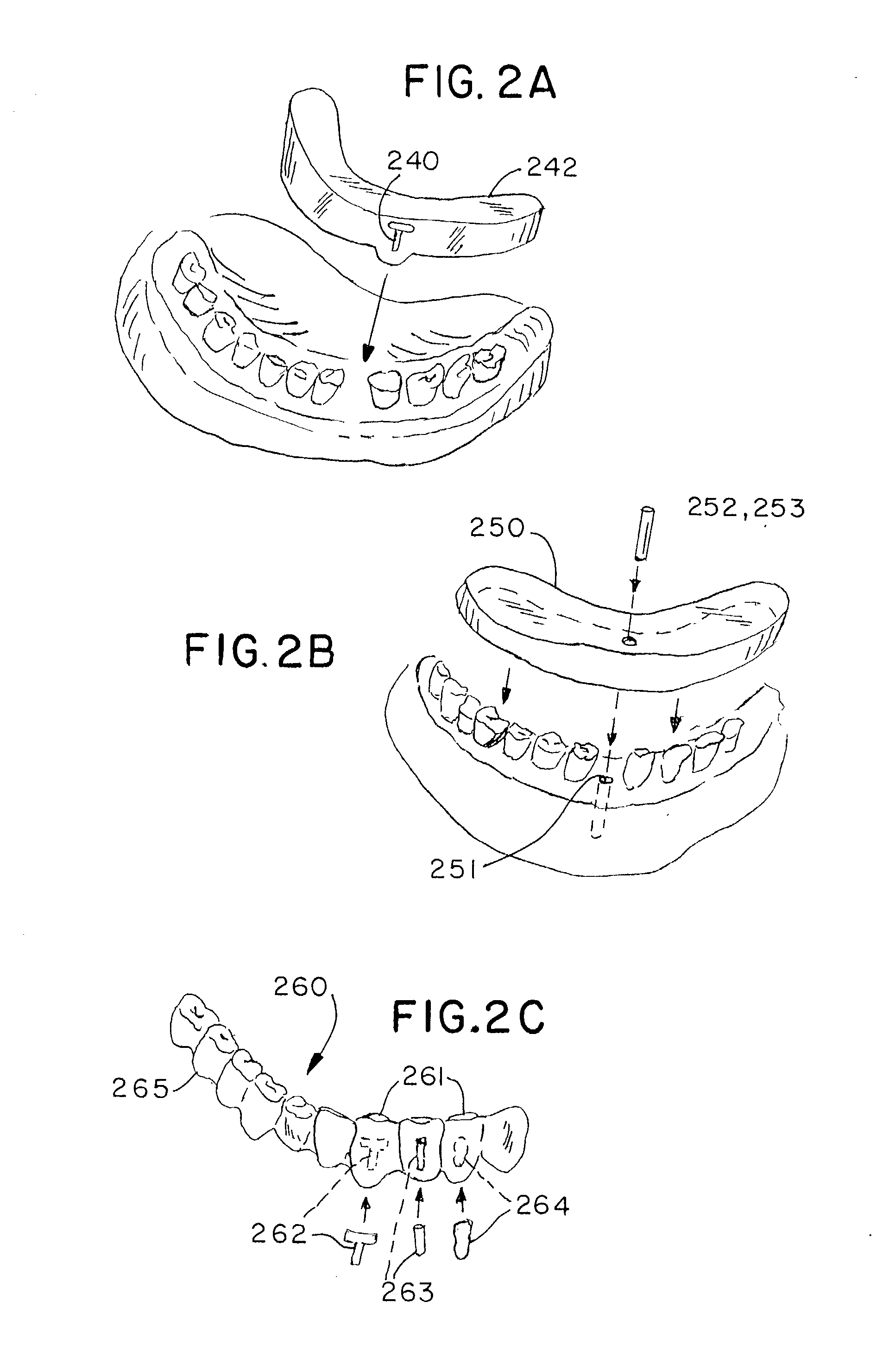 Stable dental analog systems