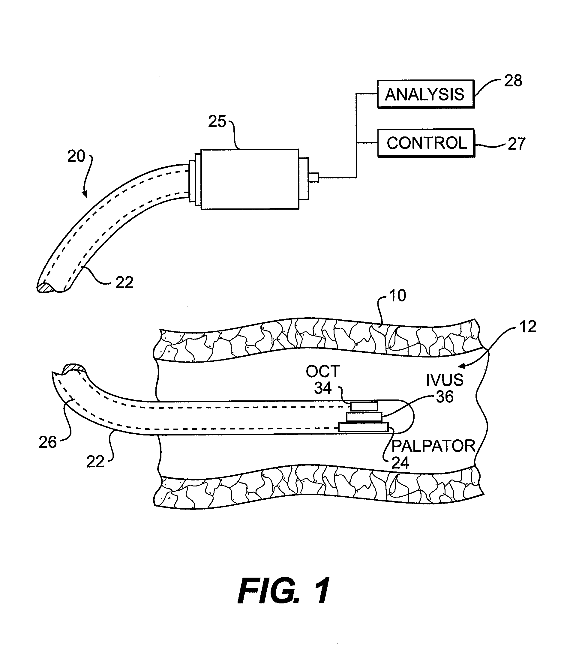 Optical coherence tomography catheter for elastographic property mapping of lumens utilizing micropalpation