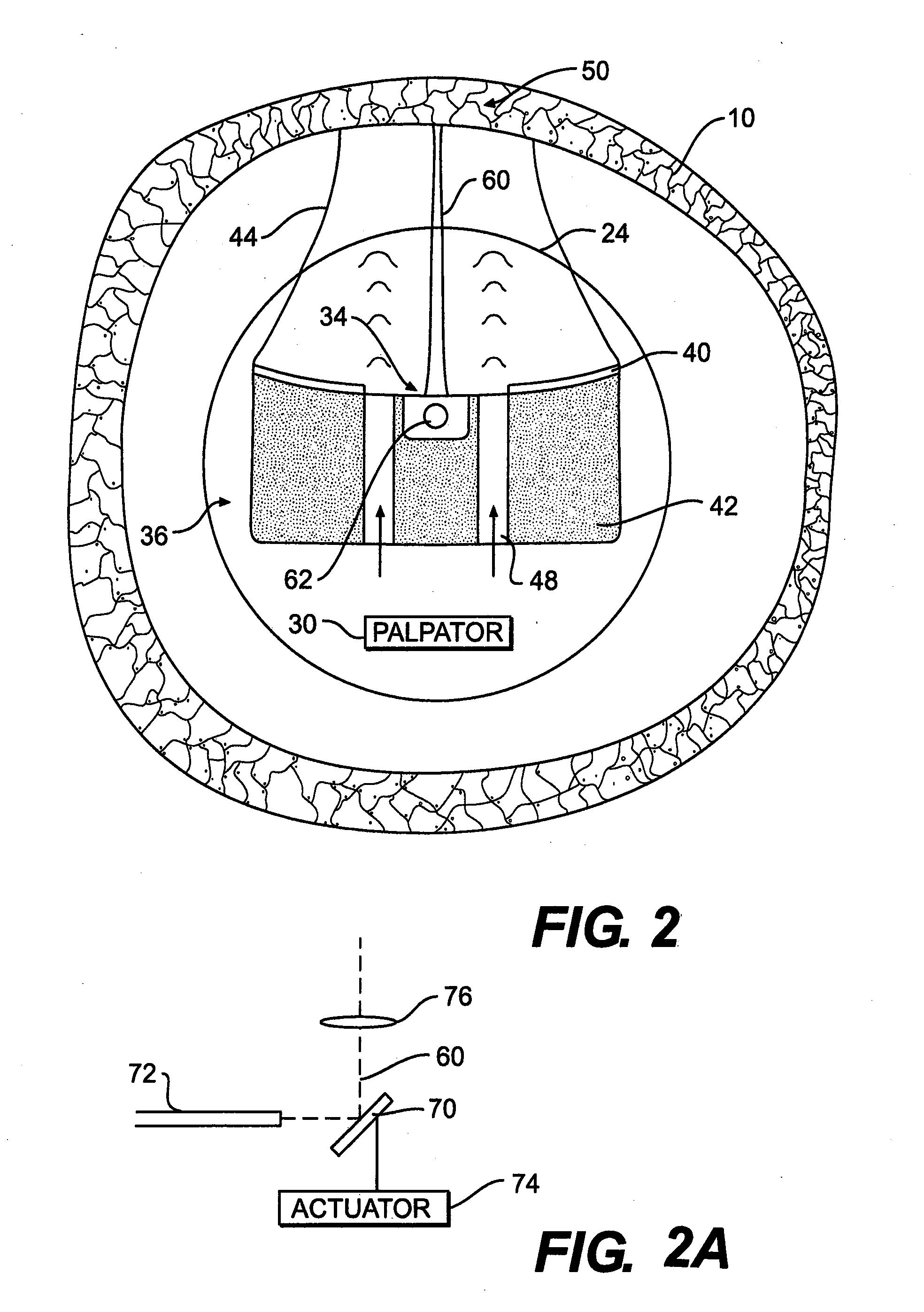 Optical coherence tomography catheter for elastographic property mapping of lumens utilizing micropalpation