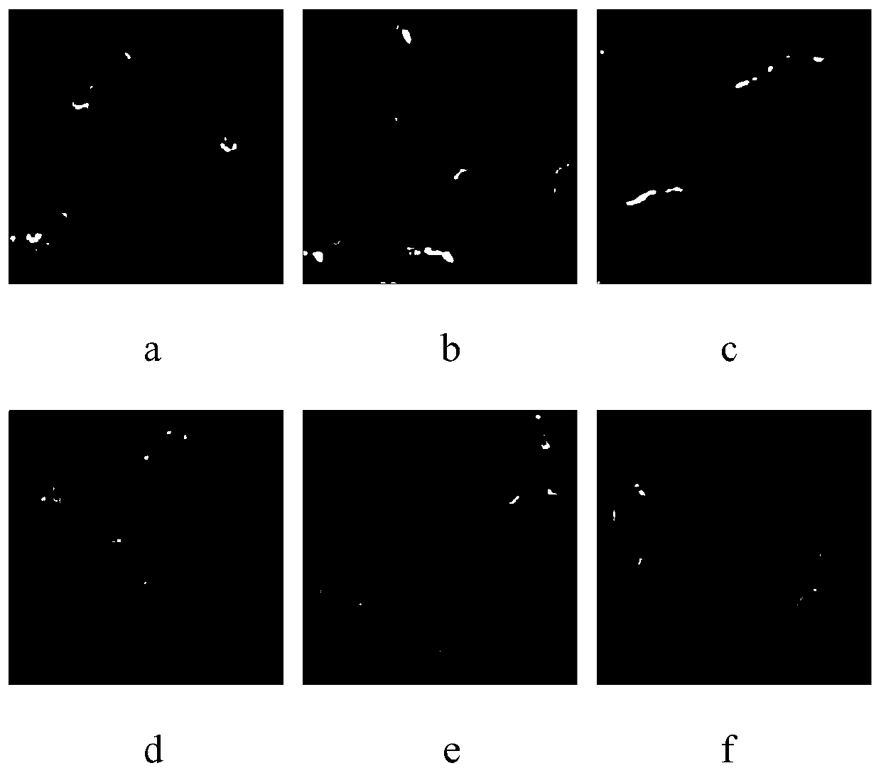 Method for establishing nasopharyngeal carcinoma distant metastasis predicting model