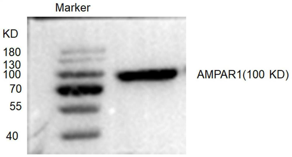 Detection material, preparation method and application of anti-ampa1 autoantibody in human body fluid