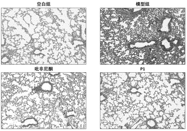 Application of N-substituted phenyl-2-pyridone compounds or pharmaceutically acceptable salts thereof in treatment of pulmonary fibrosis