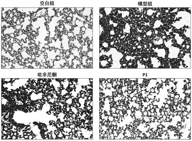 Application of N-substituted phenyl-2-pyridone compounds or pharmaceutically acceptable salts thereof in treatment of pulmonary fibrosis