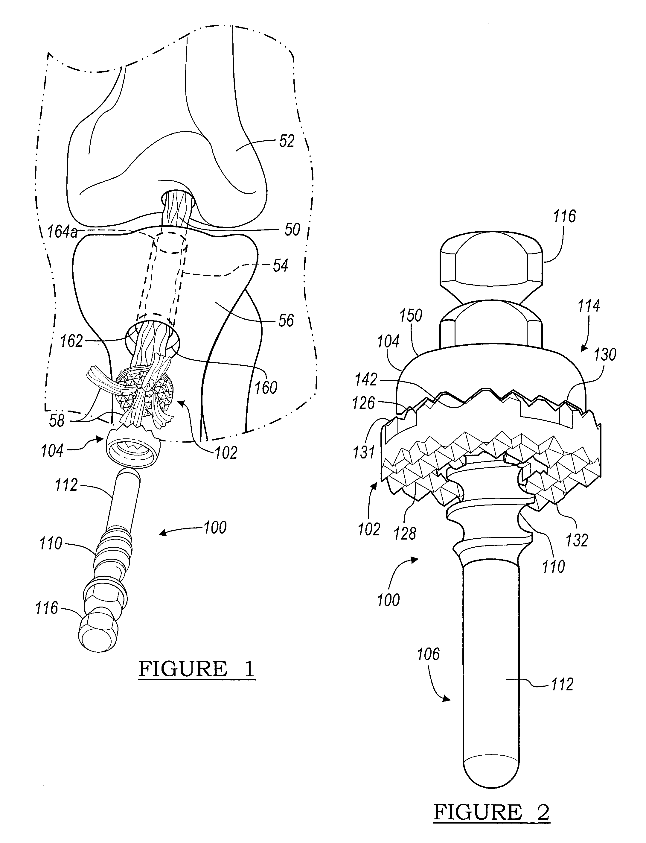 Device and method of fastening a graft to a bone