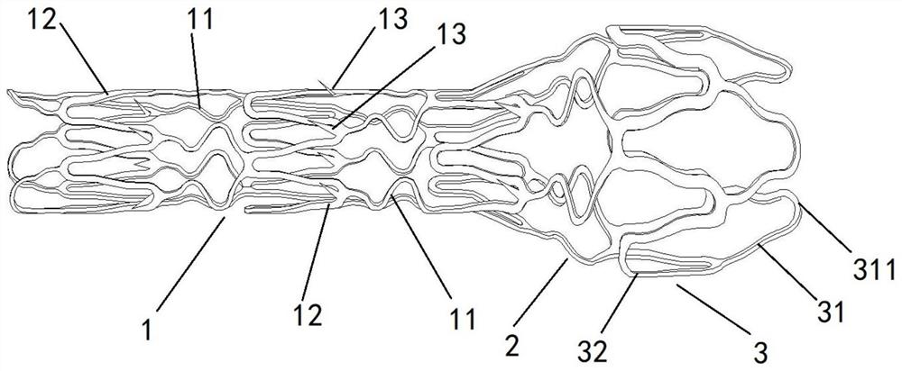 High-strength urethral stent easy to recycle