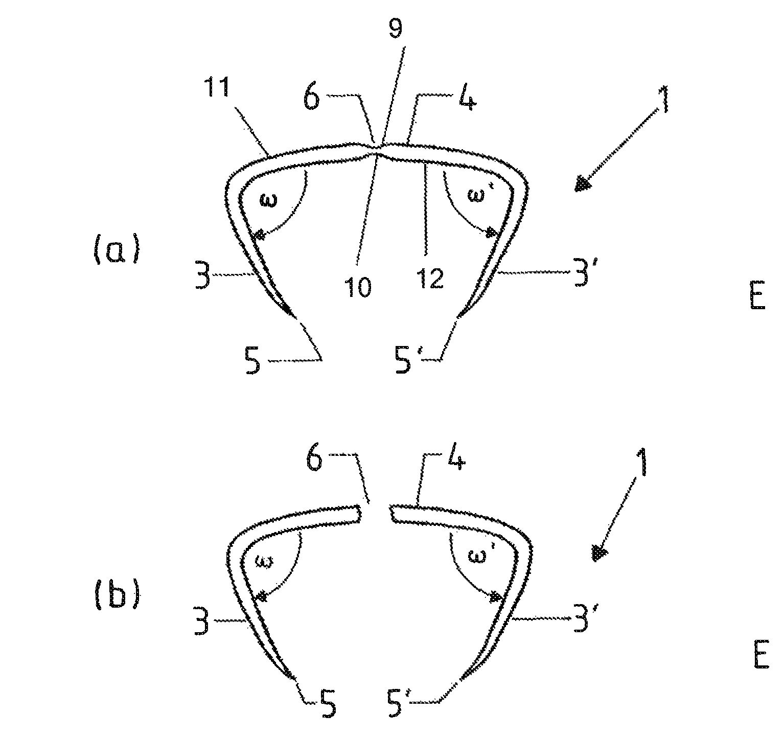 Clip-like implant for osteosynthesis