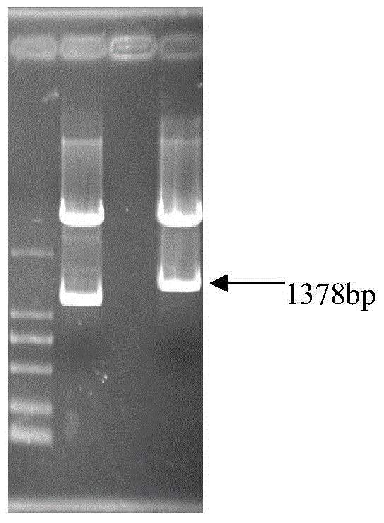 Aphis gossypii nervous centralis specificity expression Ace2 promoter and activity analysis