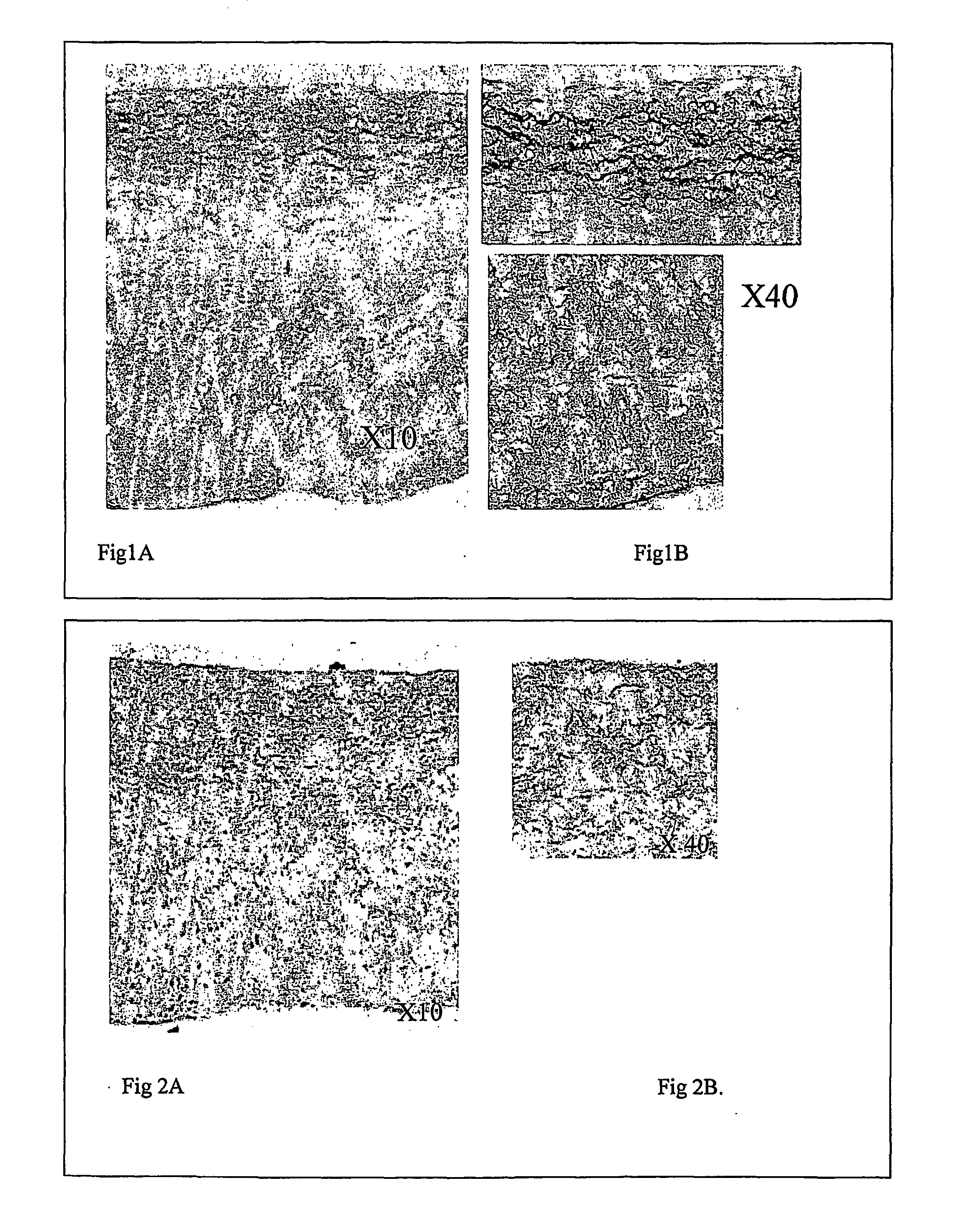 Decellularisation of matrices