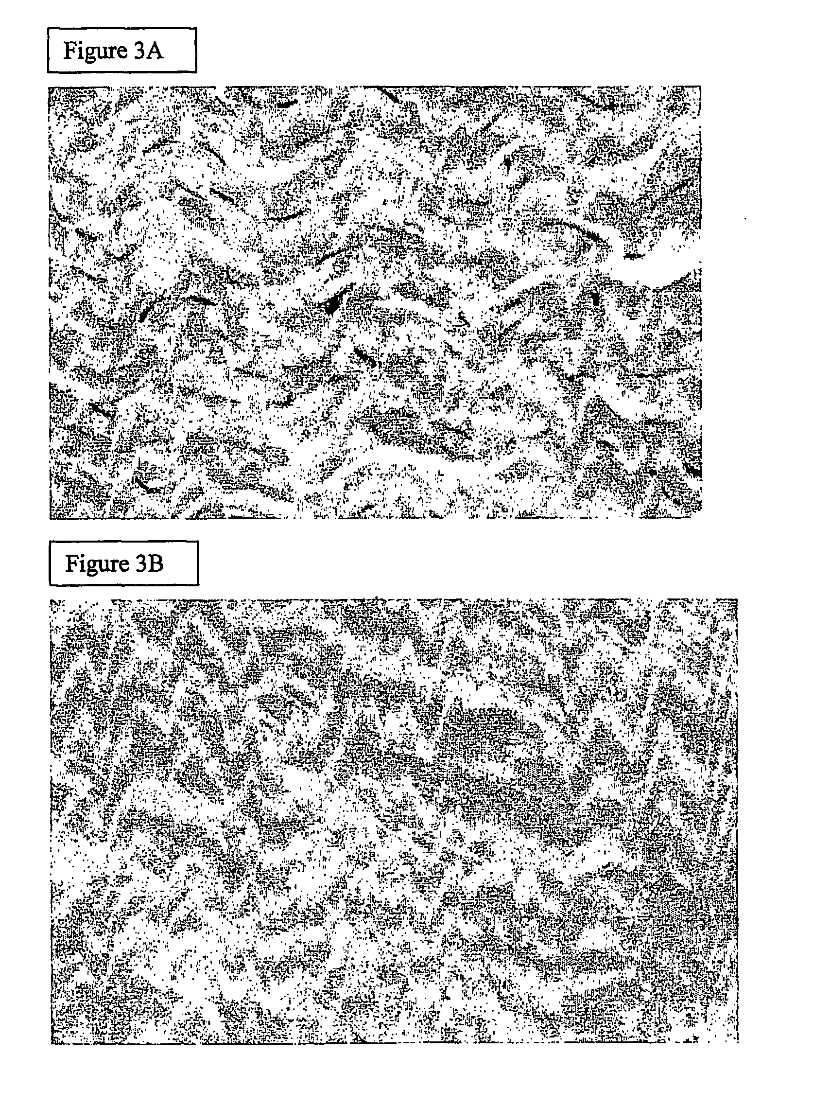 Decellularisation of matrices