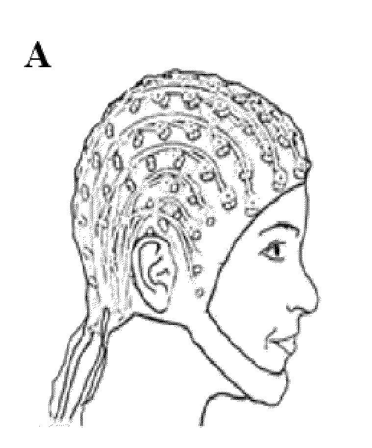 Brain state dependent therapy for improved neural training and rehabilitation