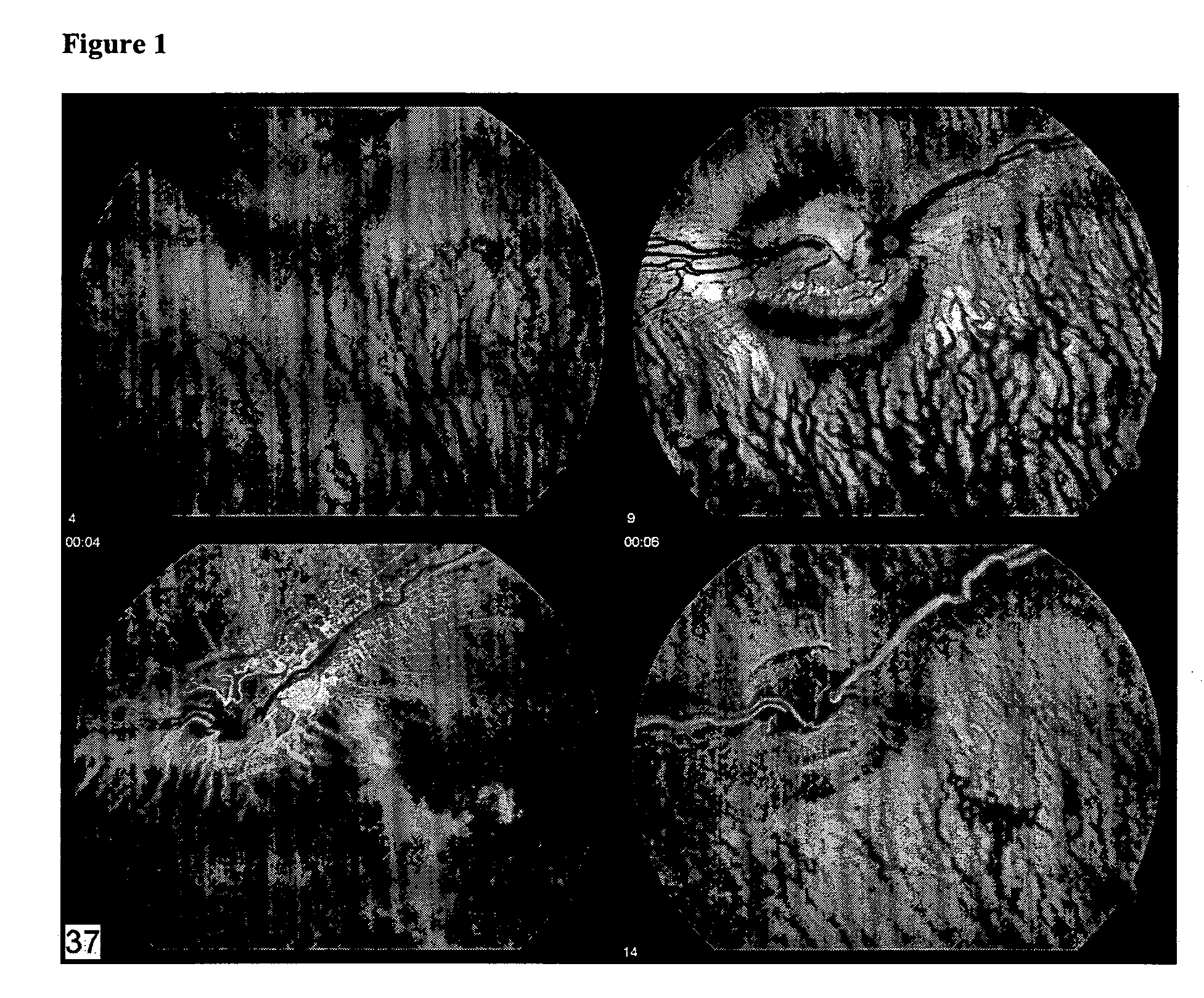 Compositions and methods for treating ophthalmic disorders