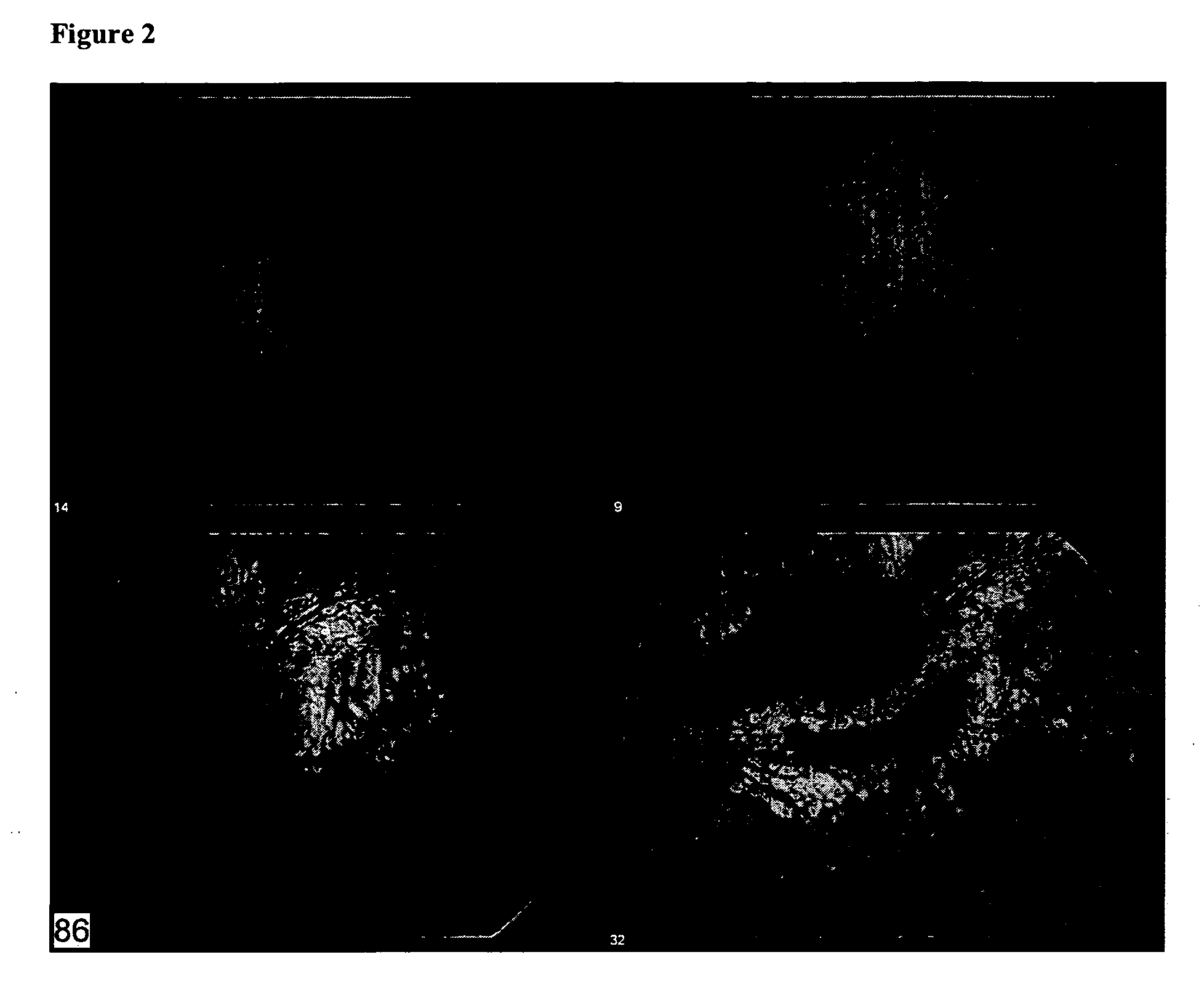 Compositions and methods for treating ophthalmic disorders