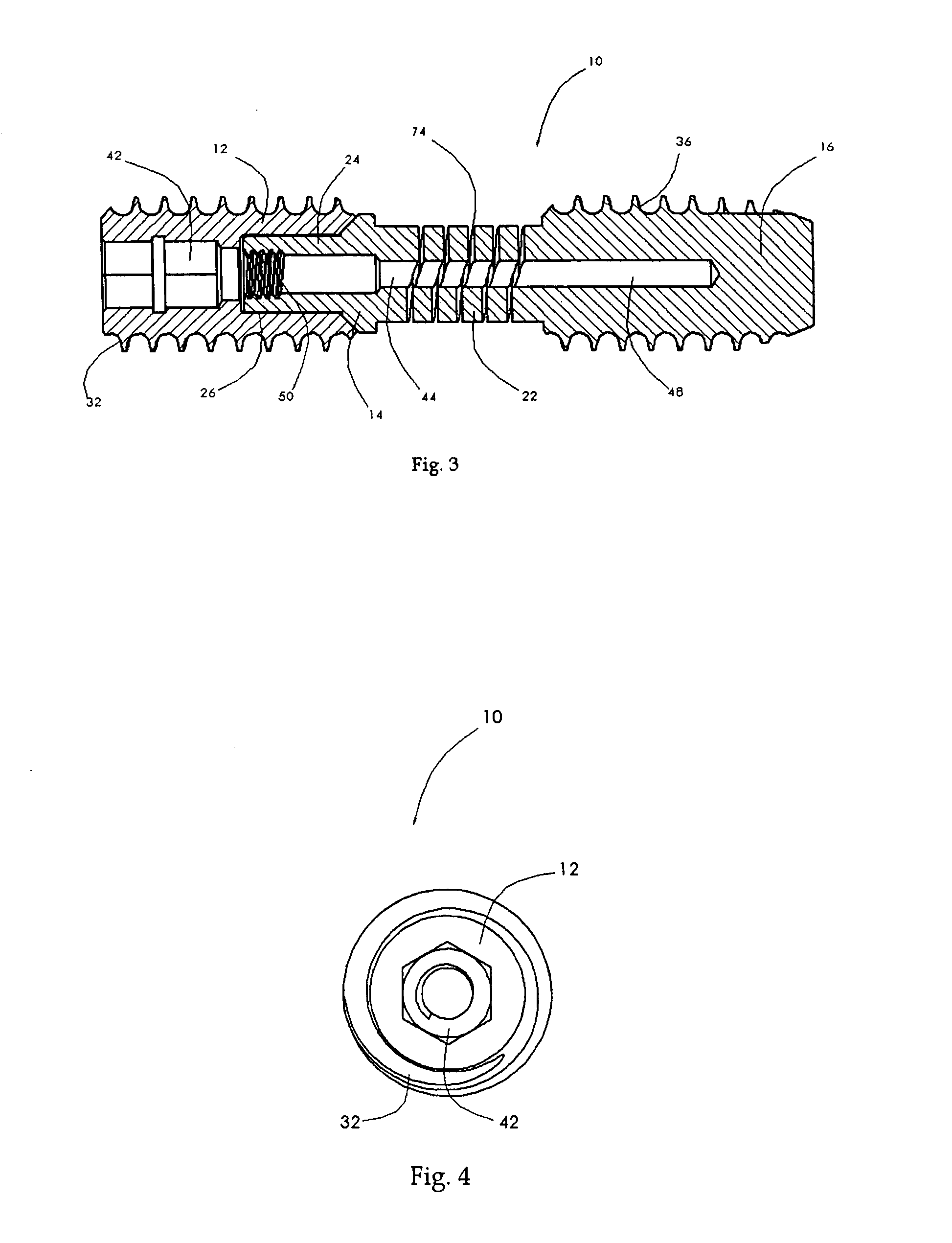 Spinal mobility preservation apparatus having an expandable membrane