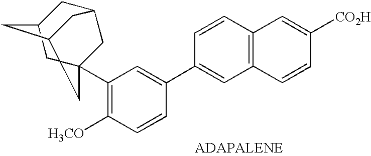 Topical preparation for treating acne and hirsutism