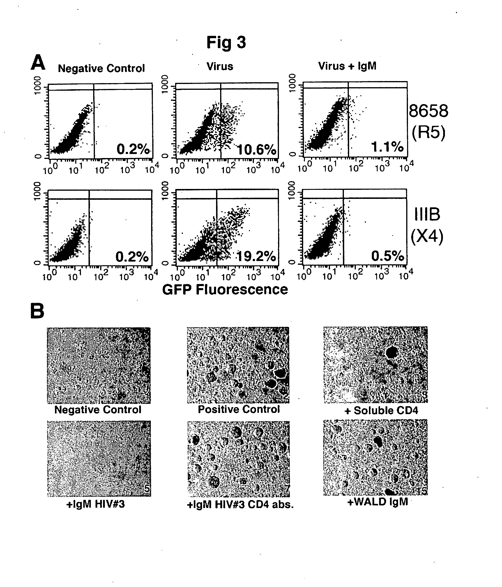 Naturally occurring IgM antibodies that bind lymphocytes