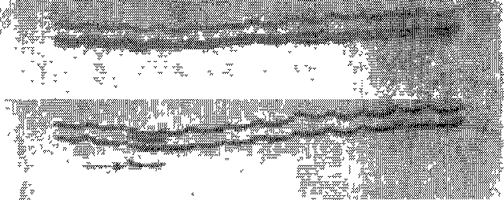 Multiple PCR reagent kit detecting breast cancer susceptibility gene mutation and preparation method thereof