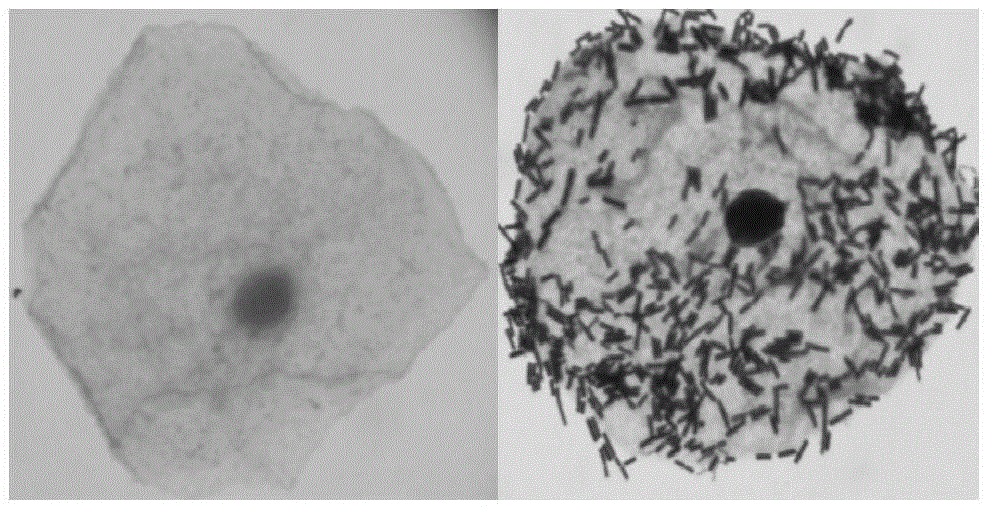 Lactobacillus. crispatus strain, and microecological preparation thereof