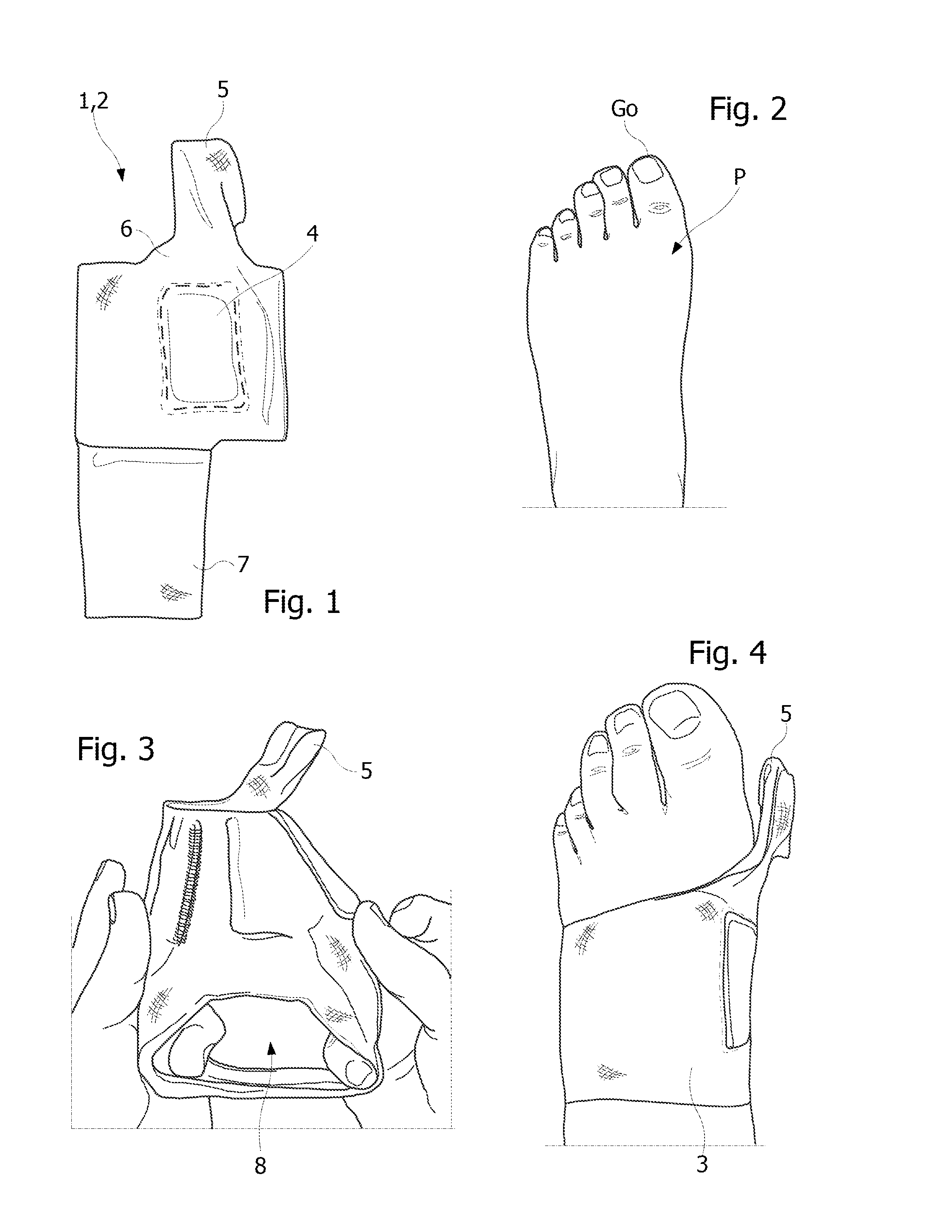 Orthopedic device for the mechanical treatment of hallux valgus